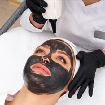 CARBON PEEL-FULL FACE (PACK OF 3) at VERSPA LASER AESTHETICS in Baldwin, NY