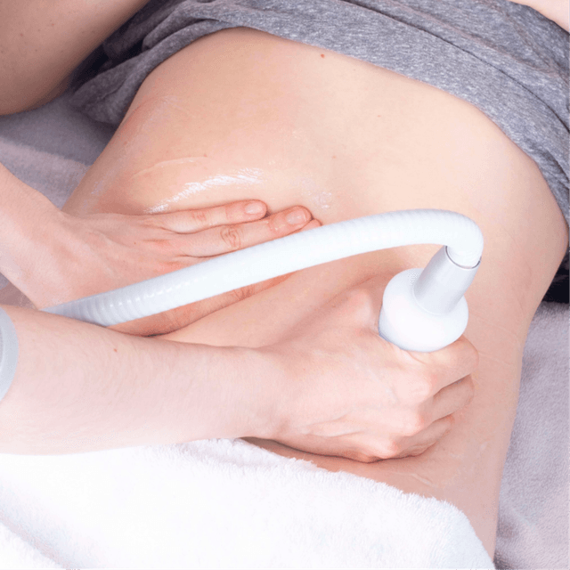 INTRO SPECIAL BODY COUNTORING at VERSPA LASER AESTHETICS in Baldwin, NY